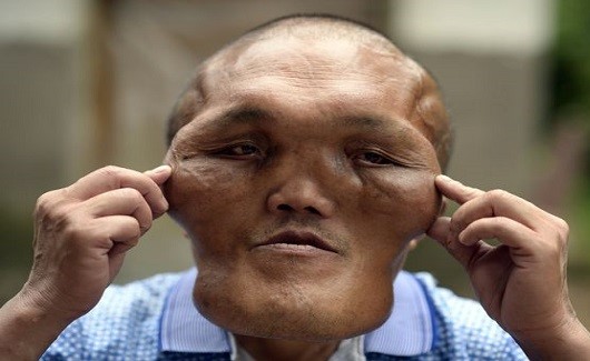شاهد.. كيف أصبح هذا الرجل أشبه بالمخلوقات الفضائية