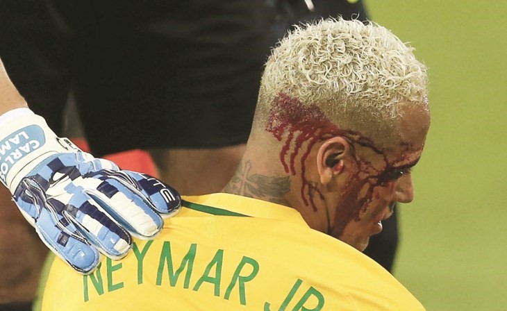 الدماء تغطي وجه نجم البرازيل نيمار بعد تدخل من لاعب بوليفيا	اپ﻿