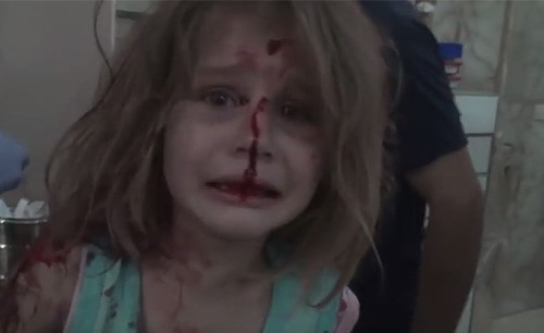 فيديو مؤلم لطفلة سورية جريحة تنادي والدها