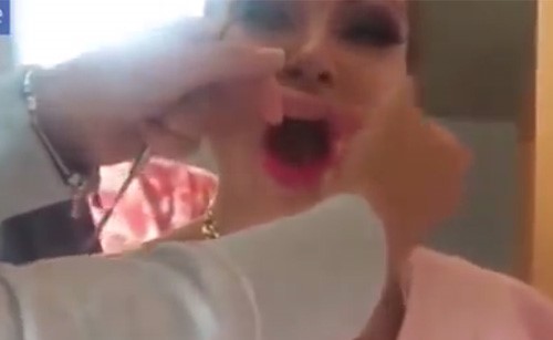فيديو لا يصدق.. نجمة عالمية تصدم الجمهور بنزع شفاهها الصناعية