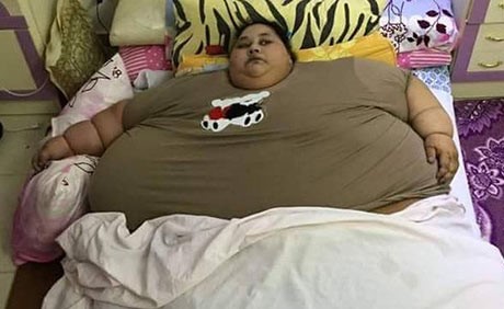 صورة.. مصرية وزنها نصف طن ولم تخرج من منزلها منذ ربع قرن