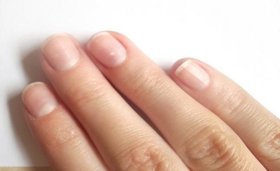 طبيب نرويجي: أطوال أصابع اليد تدل على ميول الإنسان