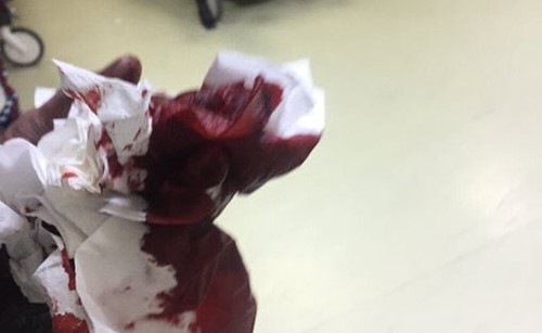 سائق تاكسي يعتدي بآلة حادة على مواطن في إسطنبول