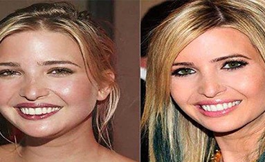 شاهد ابنة ترامب الجميلة قبل عمليات التجميل!