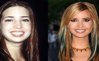 شاهد ابنة ترامب الجميلة قبل عمليات التجميل!
