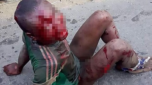 مشاهد وحشية.. طفل يتعرض لأبشع واقسى اشكال التعذيب قبل أن يُقتل حرقاً والسبب !
