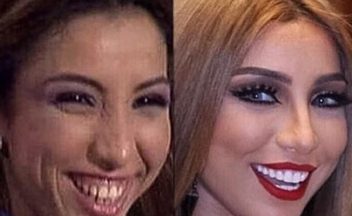 بالصور.. شاهدوا كيف كانت دنيا بطمة قبل عمليات التجميل.. لن تعرفوها!