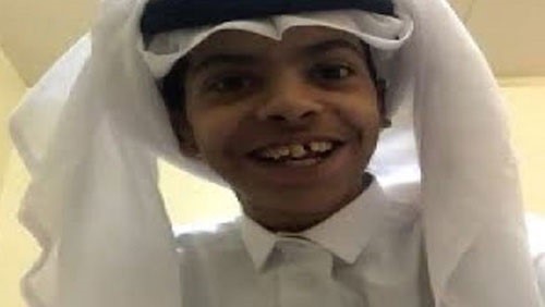 أبو سن: لهذا لم اجر عملية تجميل لاسناني .. وهذه شخصيتي القادمة على "يوناو"