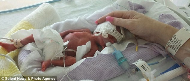 بالصور تعرف على ألفي وكونور وديلان التوأم الثلاثي الذي ولد بطول اصبع