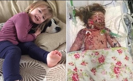 نشرا صورة ابنهما قبل وفاته بلحظات لتنبيه كل الأهل إلى خطورة هذا المرض