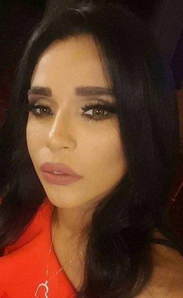 شاهد.. أحدث ظهور للمطربة الشعبية أمينة بعد عملية تجميل!
