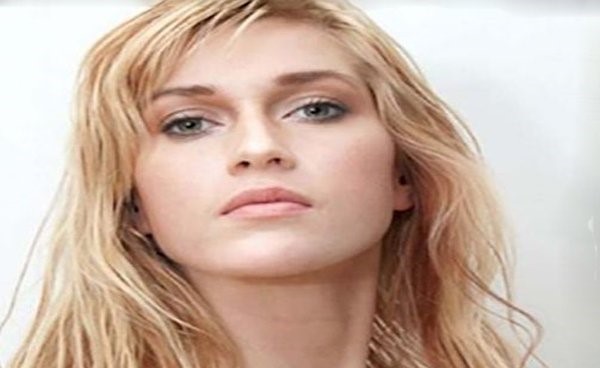 بالصور..  أجرت 18 عملية تجميل فأصبحت هكذا