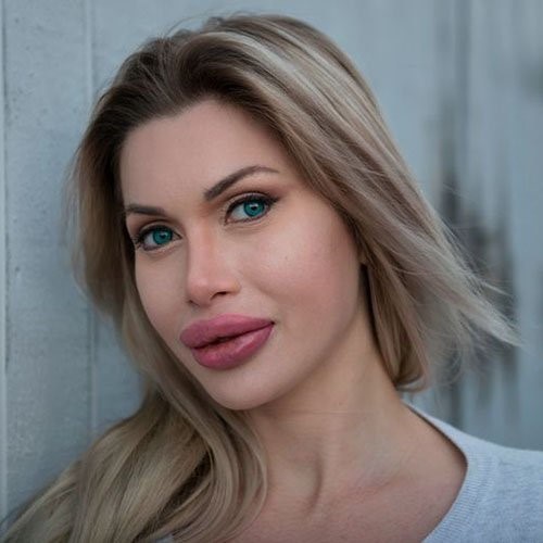 بالصور..  أجرت 18 عملية تجميل فأصبحت هكذا