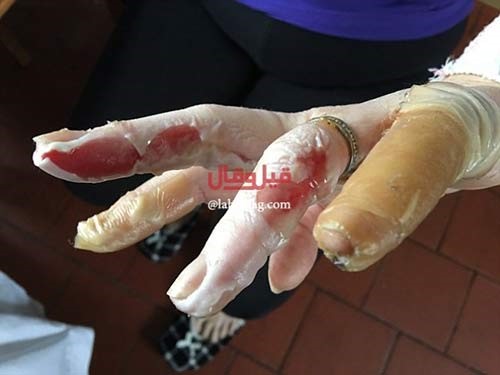 بالصور..احذروا ما قد تفعله بكم هذه اللعبة!