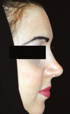 د.منال شتا لـ «الأنباء»: ابتكرت طريقة حديثة بالليزر لشد الوجه بدون بنج أو جراحة أو إبر أو خيوط جراحية
