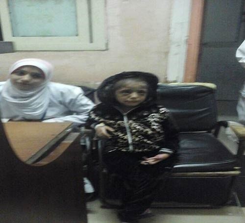 بالصور.. مصري تجرد من أبوته وعذب طفلته حرقاً.. والسبب صادم !