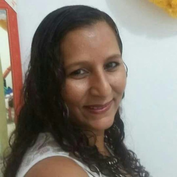 لماذا تغطي هذه السيدة حروقها بجلد السمك؟