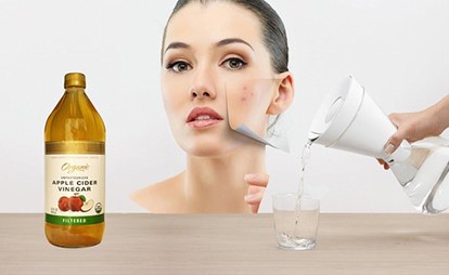 10 استعمالات تجميلية لخل التفاح.. تعرّفي عليها