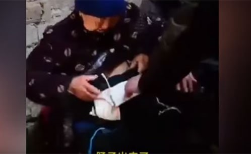 بالفيديو.. امرأة تحمل أمعاءها في كيس من البلاستيك منذ 20 عاماً !