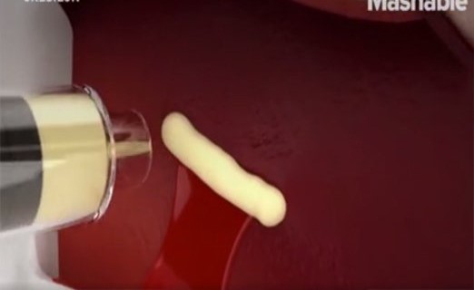 بالفيديو.. ابن الـ 17 عاما يخترع مرهم سحريّ لإيقاف النزيف في ثوانٍ!
