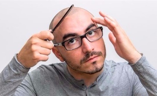 لهذه الأسباب لا تخجل من حلق كامل شعر رأسك