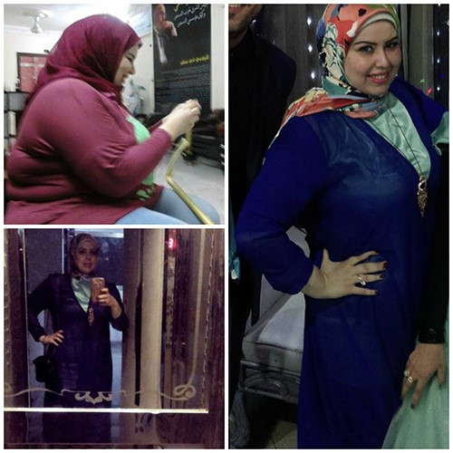 بالصور.. هذا ما فعلته عشرينية مصرية وأخفته عن أهلها وخطيبها وكاد أن يكلفها حياتها ..إليكم القصة