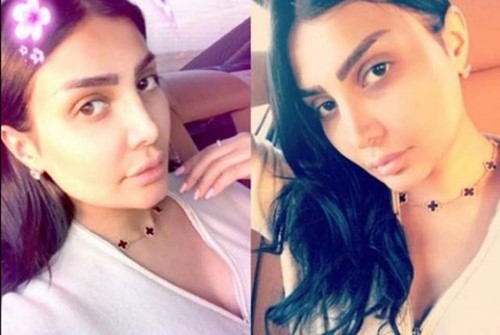 صورة: أمل العوضي من دون ماكياج.. بعض العلامات أثارت حيرة جمهورها!