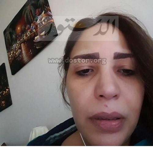 بالفيديو..فنانة سورية تروي تفاصيل محاولة قتلها على يد زوجها ضابط الشرطة السابق