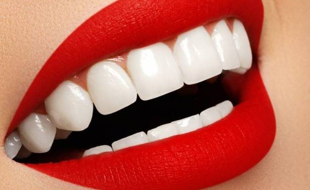 لابتسامة هوليوود براقة.. إليك السر
