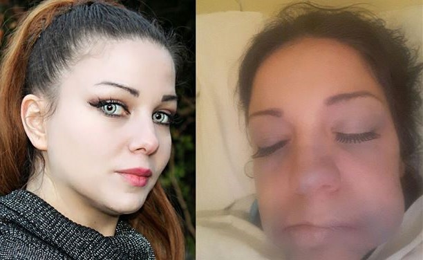 شاهد..  عملية تجميل تُشوّه وجه فنانة لبنانية .. وتتوعد الطبيب!!