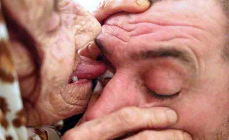 صورة صادمة تستخدم لسانها لعلاج مرضاها من العمى