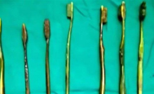 فتاة تبتلع 7 فراشي أسنان بعد محاولة إجبارها على الزواج