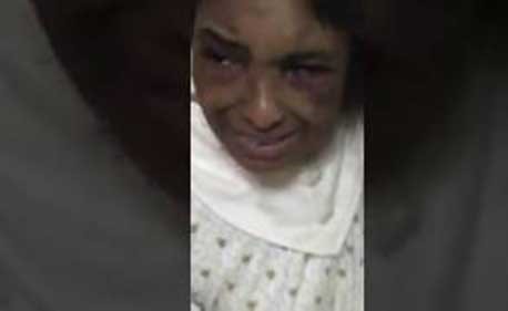 فيديو مؤثر .. كفيل يعتدي على خادمته ويشوه وجهها بلا رحمة في السعودية !