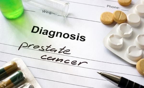الأسبرين يقلل خطر إصابة الرجال بسرطان بروستات قاتل