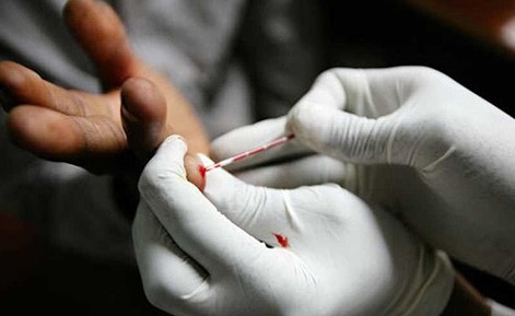 تدافع عدد كبير من سكان دولة عربية على مراكز فحص “الإيدز” لسبب غريب!