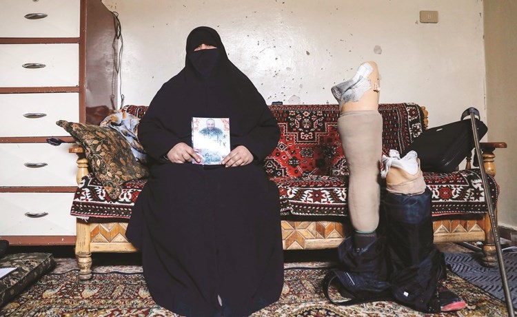 جدة الشاب عدنان الذي فقد ساقيه في غارة على دوما تحمل صورة ولدها القتيل مع الساقين الاصطناعيتين لحفيدها 	أ.ف.پ﻿