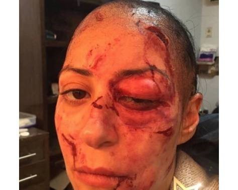 بالفيديو والصور.. منة شلبي تتعرض للتشويه.. إليكم ما حصل معها!!