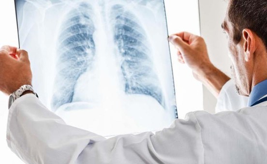 تطوير تقنية لفحص الرئة تقلل من استخدام المضادات الحيوية