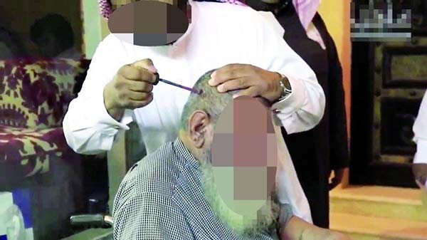 بعد انتشار مقطع له على مواقع التواصل وتهافت الناس عليه.. إيقاف ممارس الطب الشعبي بالكي في السعودية