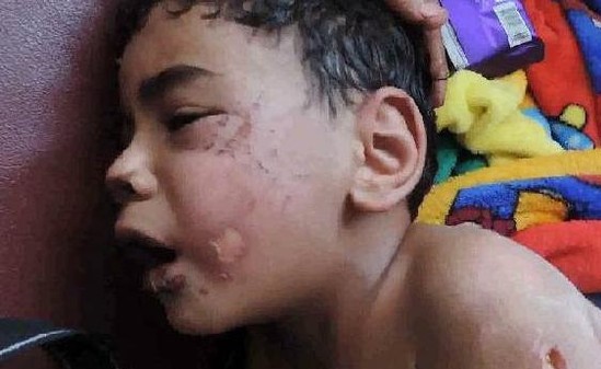 أحرق طفل زوجته ونزع أظافره.. والصدمة لم تأت بعد!