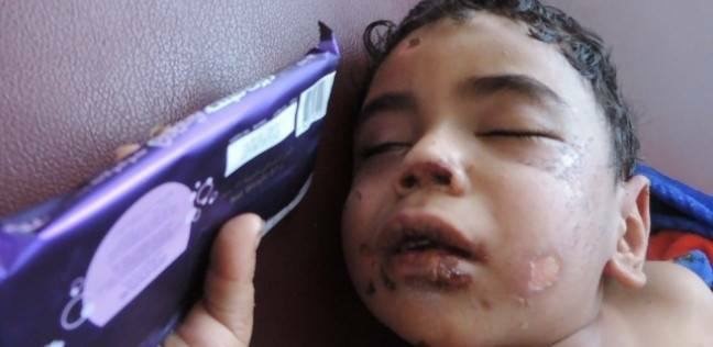 أحرق طفل زوجته ونزع أظافره.. والصدمة لم تأت بعد!