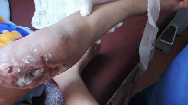أحرق طفل زوجته ونزع أظافره.. والصدمة لم تأت بعد!