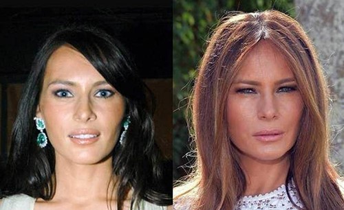 بالصور.. الكشف عن عدد عمليات التجميل التي أجرتها ميلانيا ترامب.. وكلفتها الخيالية!
