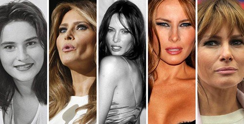 بالصور.. الكشف عن عدد عمليات التجميل التي أجرتها ميلانيا ترامب.. وكلفتها الخيالية!