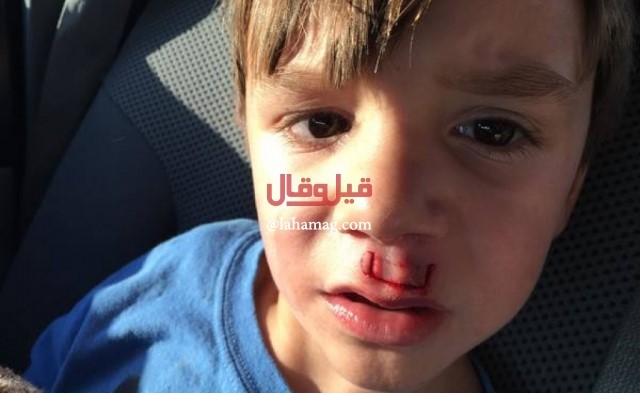 ضحية جديدة للعبة سبينر... ما فعله بها هذا الأب أودى بطفله إلى المستشفى