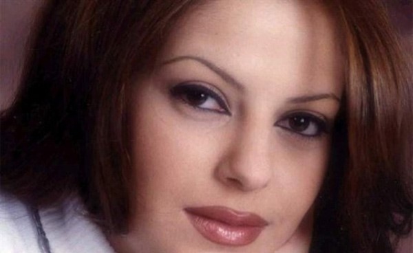 بالصور..لن تصدقوا من هذه النجمة العربية قبل عمليات التجميل!