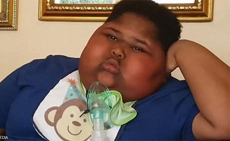 طفل يعاني شهية "استثنائية" ويأكل كل شيء