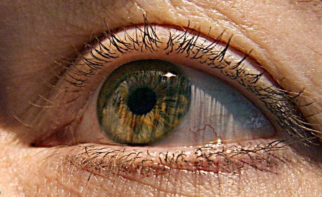 نصائح طبية للحجاج للحفاظ على سلامة العين