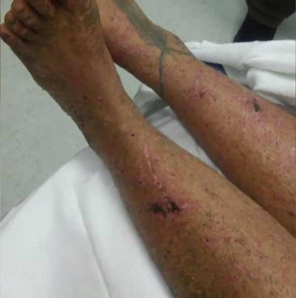 بالصور.. فتاة قوية تنقذ نفسها من الغابات بعد فقدانها لمدة شهر