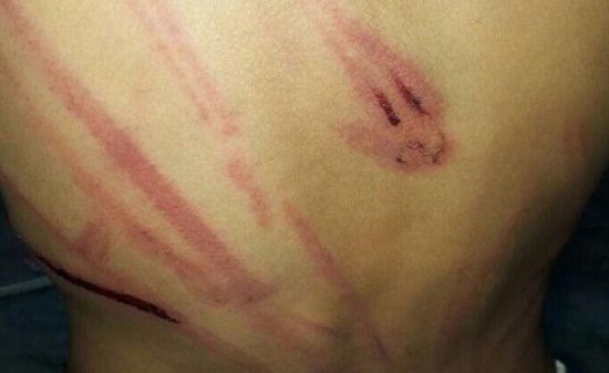 السعودية.. "يتيم" يتعرض لضرب مبرح من أخواله
